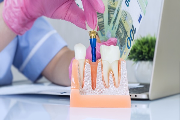 Common Signs Of Gum Disease Around Dental Implants